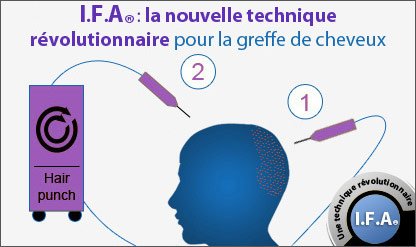 Schema Ifa